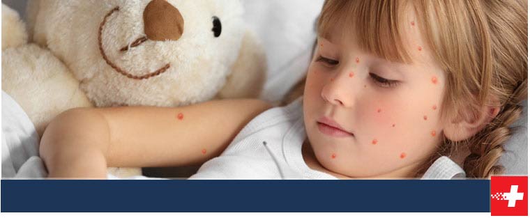 Chicken Pox Treatment Near Me in Oklahoma City, OK