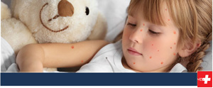 Chicken Pox Treatment Near Me in Oklahoma City, OK