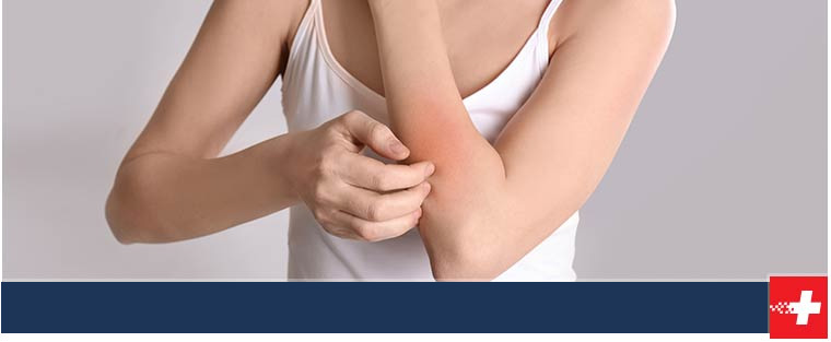 Rash & Allergic Reactions Treatment Near Me in West Moore OK, Norman (HealthPlex) OK, Norman (24th) OK, Edmond OK, Yukon OK, I-240 and Sooner RD OK, Tecumseh OK Rash & Allergic Reactions Treatment Near Me in West Moore OK, Norman (HealthPlex) OK, Norman (24th) OK, Edmond OK, Yukon OK, I-240 and Sooner RD OK, Tecumseh OK