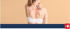 Skin Rashes Treatment Near Me in Edmond, OK