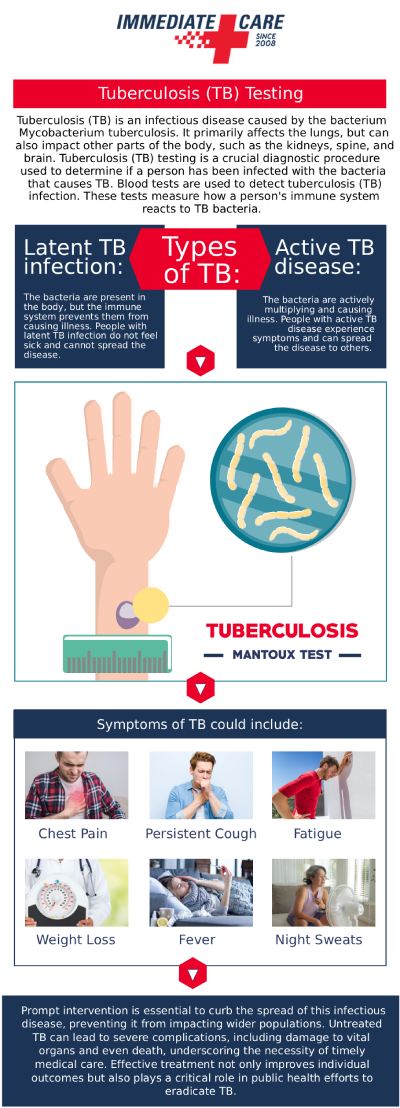 Common questions asked by clients: What is TB skin testing, and why is it important? How is the TB skin test administered? What do the results of a TB skin test mean? Who should get a TB skin test at Immediate Care of Oklahoma in Oklahoma City, OK? For more information, contact us or schedule an appointment online. We have convenient locations to serve in Oklahoma City, OK.